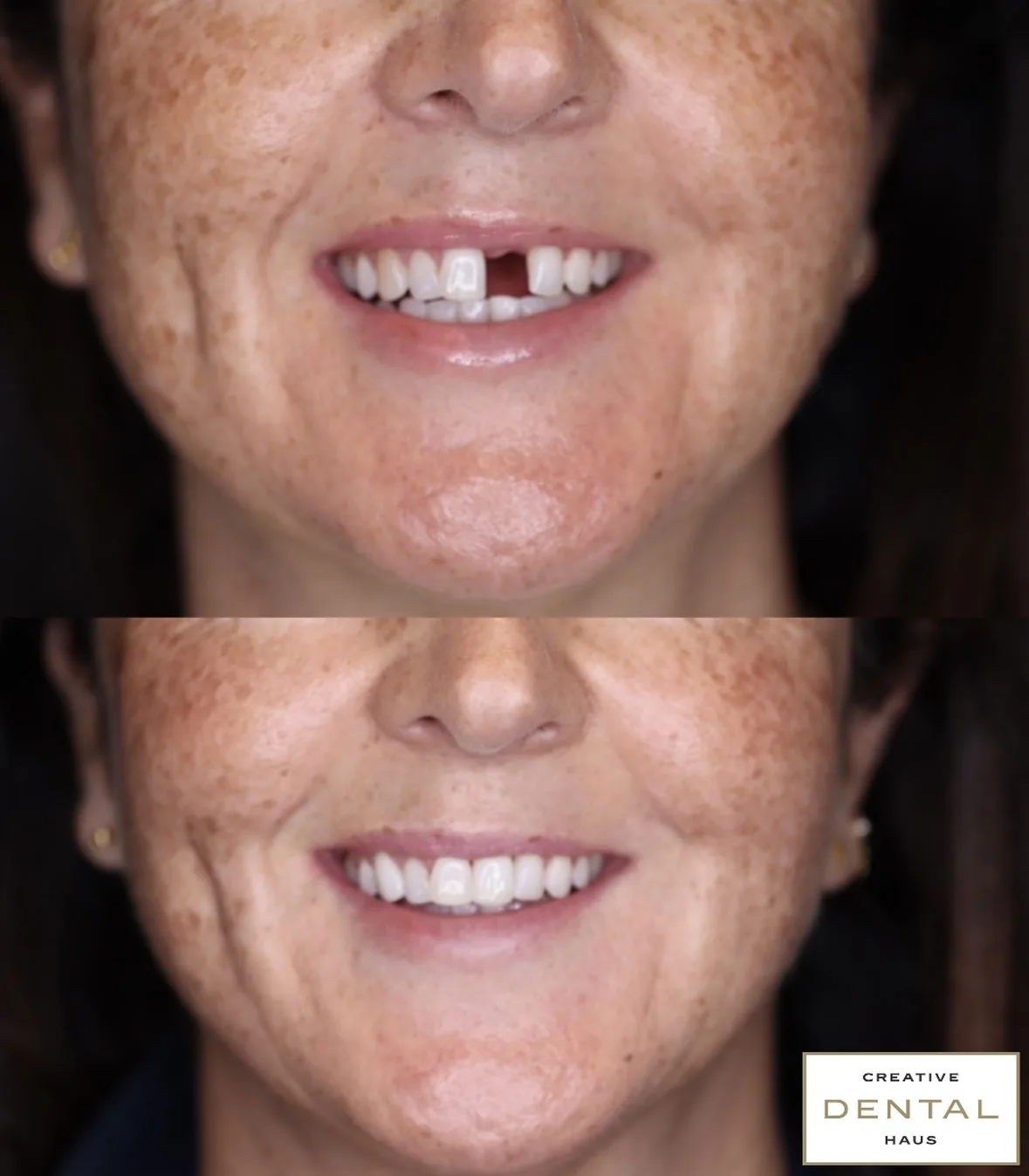 before after dental treatment cas 6