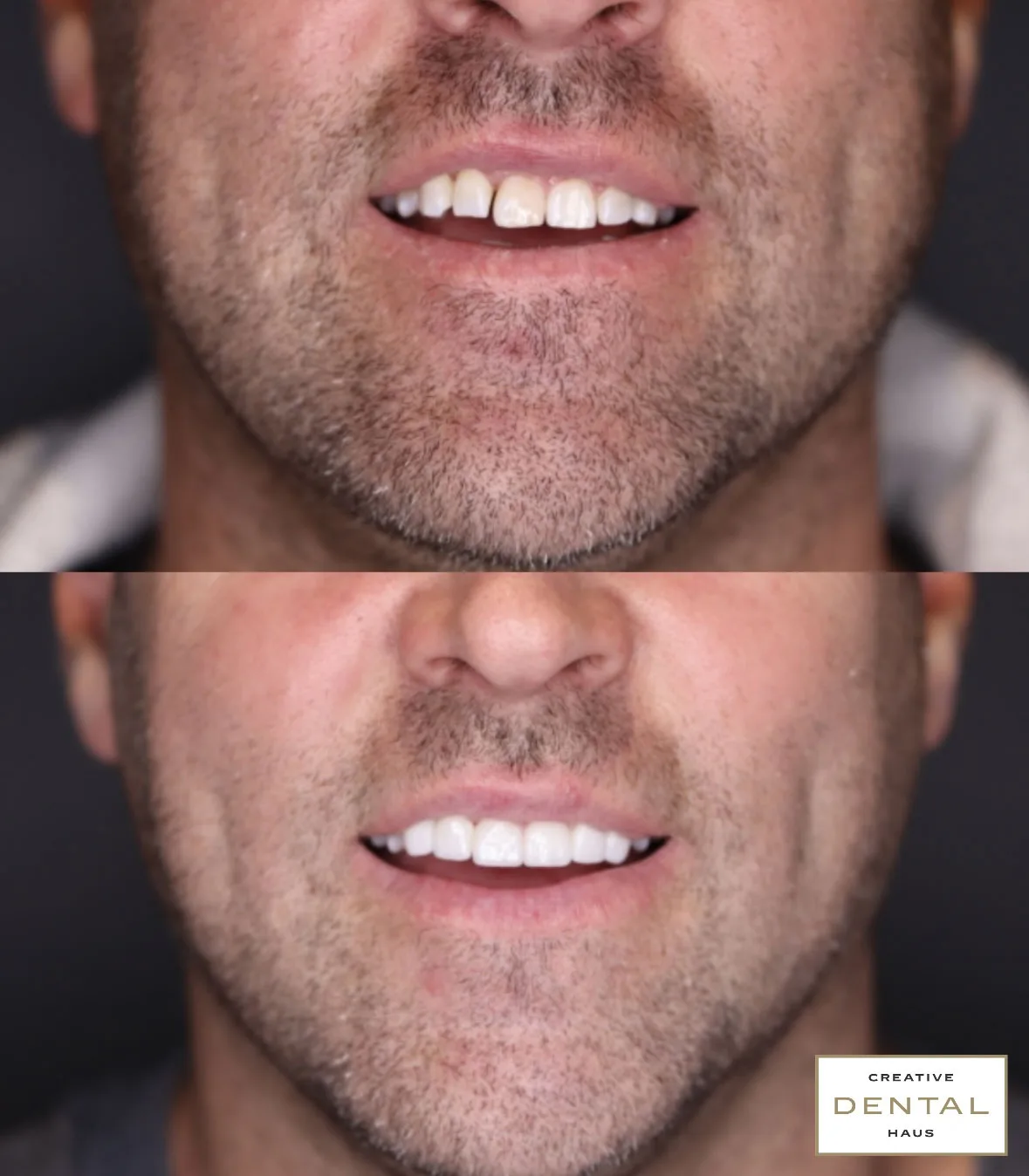 before after dental treatment case 7